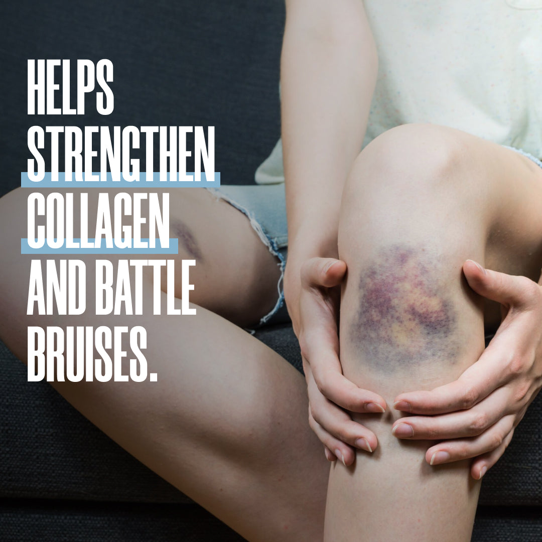 Bruise Treatment Bundle