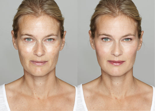 Signs your skin is aging faster than you are