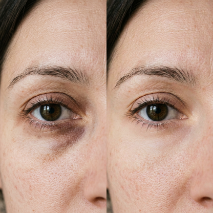 Dark Circle Eye Cream