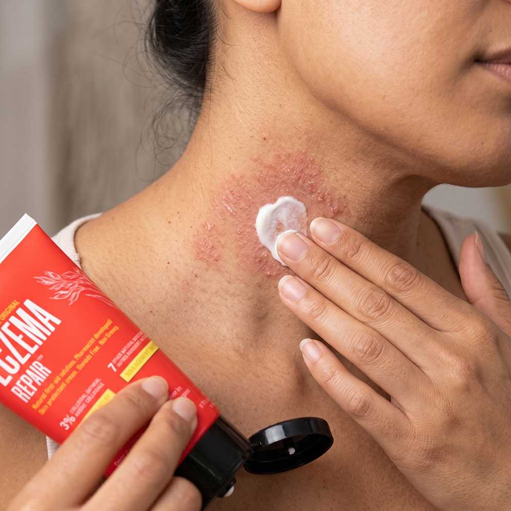Eczema Repair – Zax's Original